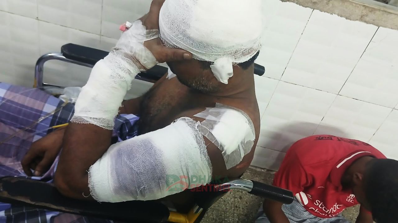 সন্দ্বীপে যুবদল নেতার নেতৃত্বে ব্যবসায়ীকে কুপিয়ে জখম
